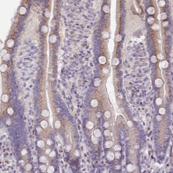 MYRFL Antibody, Novus Biologicals 0.1mL; Unlabeled:Antibodies, Polyclonal